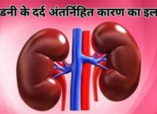 किडनी का दर्द: कैसा होता है, कहाँ होता है, कारण, जाँच, इलाज इत्यादि के दर्द अंतर्निहित कारण का इलाज (1)
